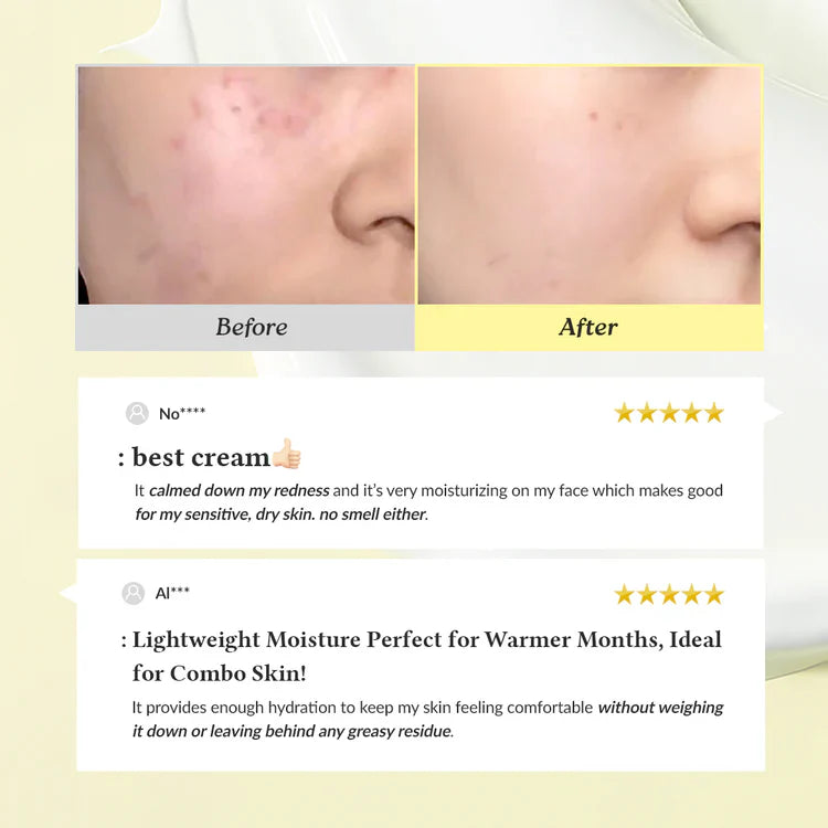 Dr. Althea 345 Relief Cream before after